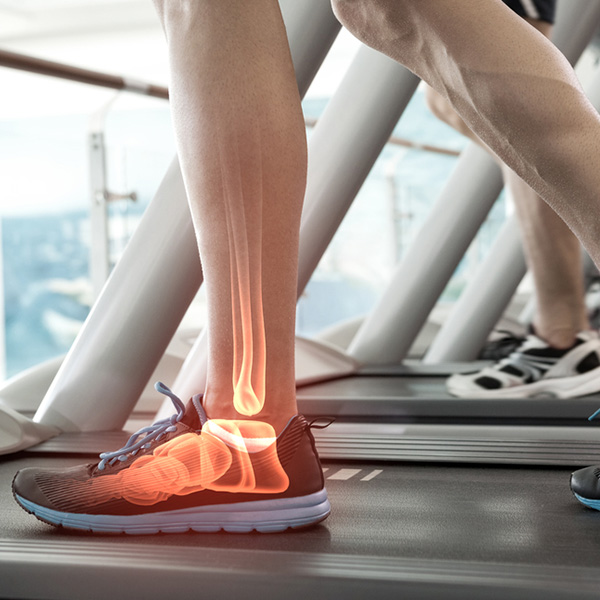 Ανατομικά Παπούτσια