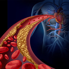 Χοληστερίνη - Τριγλυκερίδια