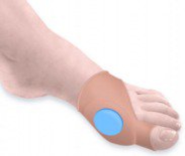 Orliman Actius Προστατευτικό για Κότσι ACP-912, 1τεμ (06712)